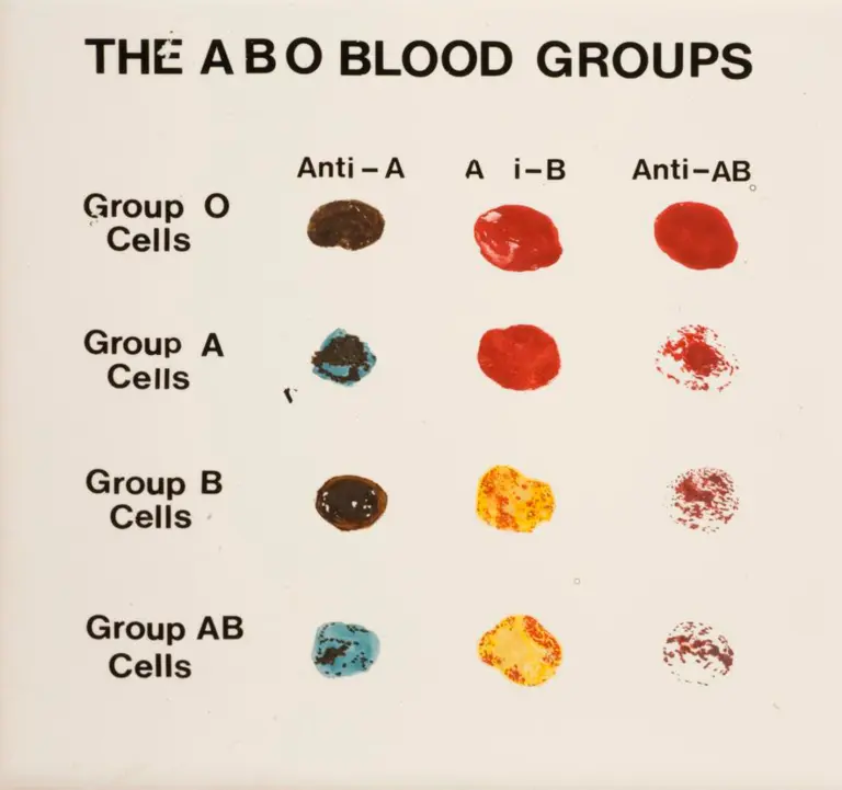 Fewer than 50 people in the world have this ‘golden’ blood type — scientists are trying to grow it in a lab